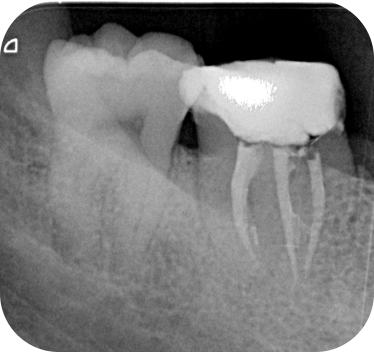 clinica dental diamante dra carlota lara