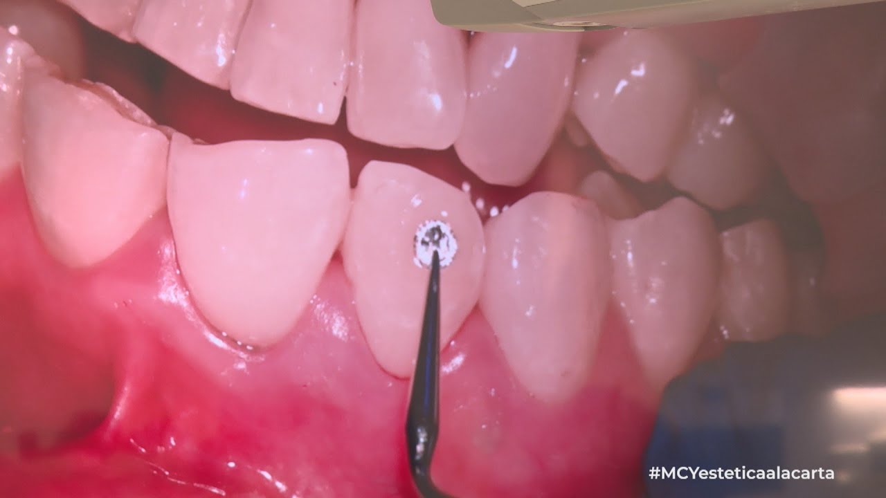 clinica dental diamante