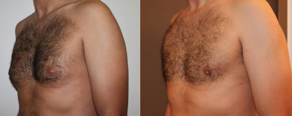 traba los chichi men 1